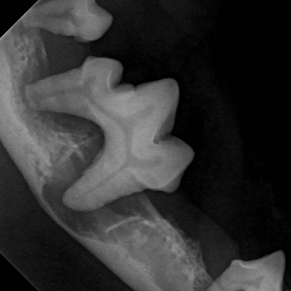 Signs of Dental disease